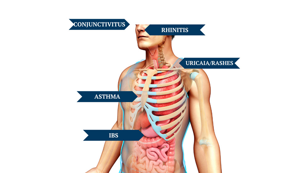 Organs affected in allergy - Allergy and Immunotherapy