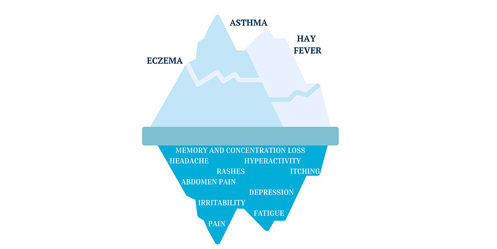 Hidden Allergy - Allergy and Immunotherapy